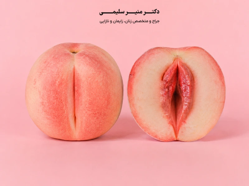 جراحی لابیاپلاستی در قم