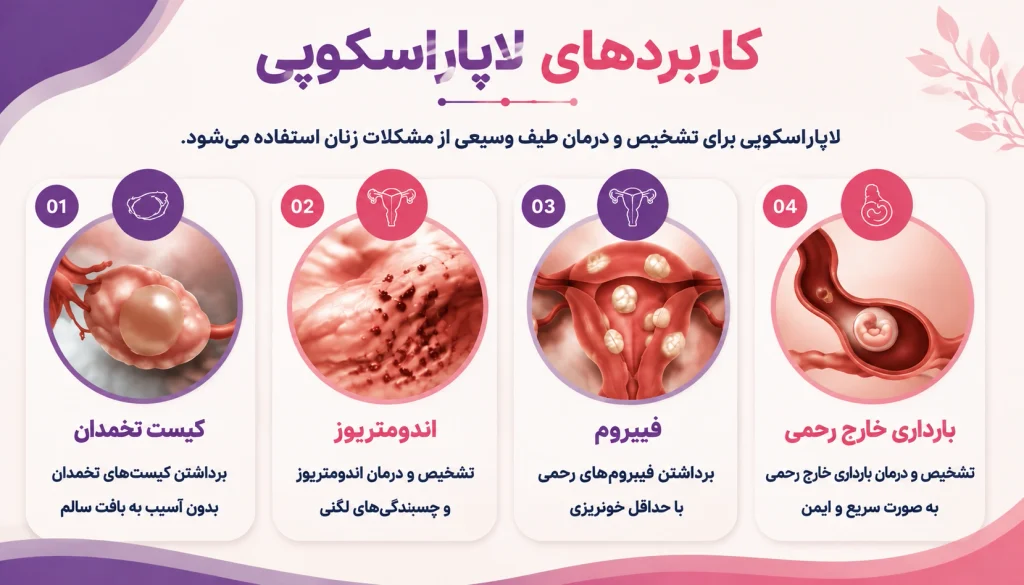 اینفوگرافیک کاربردهای لاپاراسکوپی زنان شامل کیست تخمدان، اندومتریوز، فیبروم و بارداری خارج رحمی