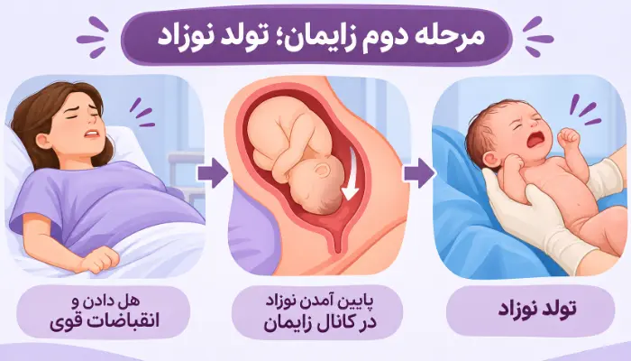 مرحله دوم زایمان طبیعی و پایین آمدن نوزاد در کانال زایمان