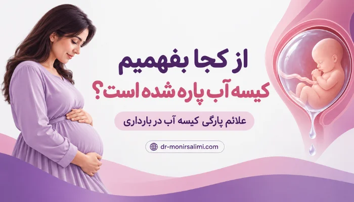 از کجا بفهمیم کیسه آب پاره شده است و علائم پارگی کیسه آب در بارداری