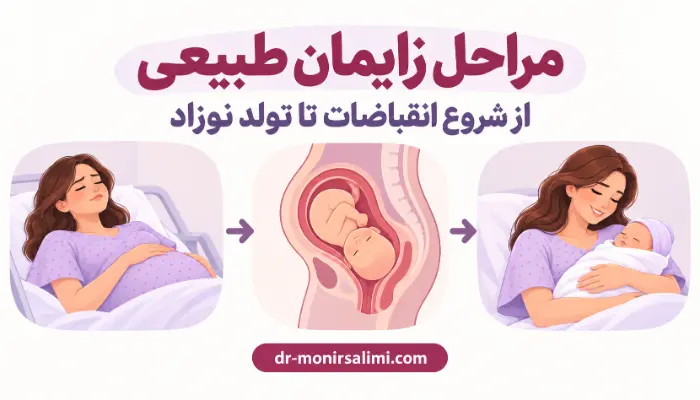 مراحل زایمان طبیعی از شروع انقباضات تا تولد نوزاد